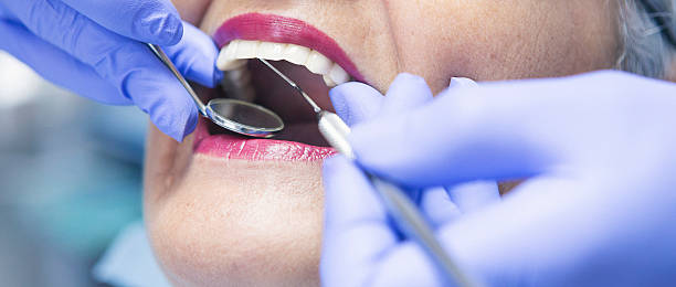 Best Emergency Broken Tooth Repair in Immokalee, FL